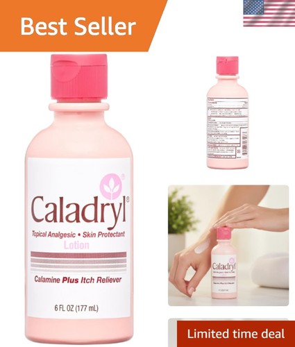 Calamine lotion for itching - lotion,